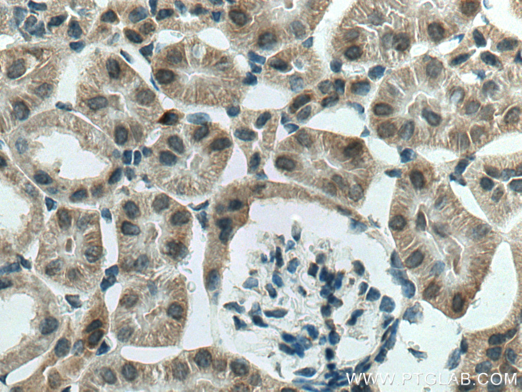 IHC staining of mouse kidney using 28454-1-AP