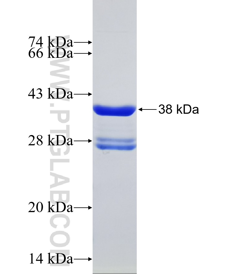 SGK1 fusion protein Ag29420 SDS-PAGE