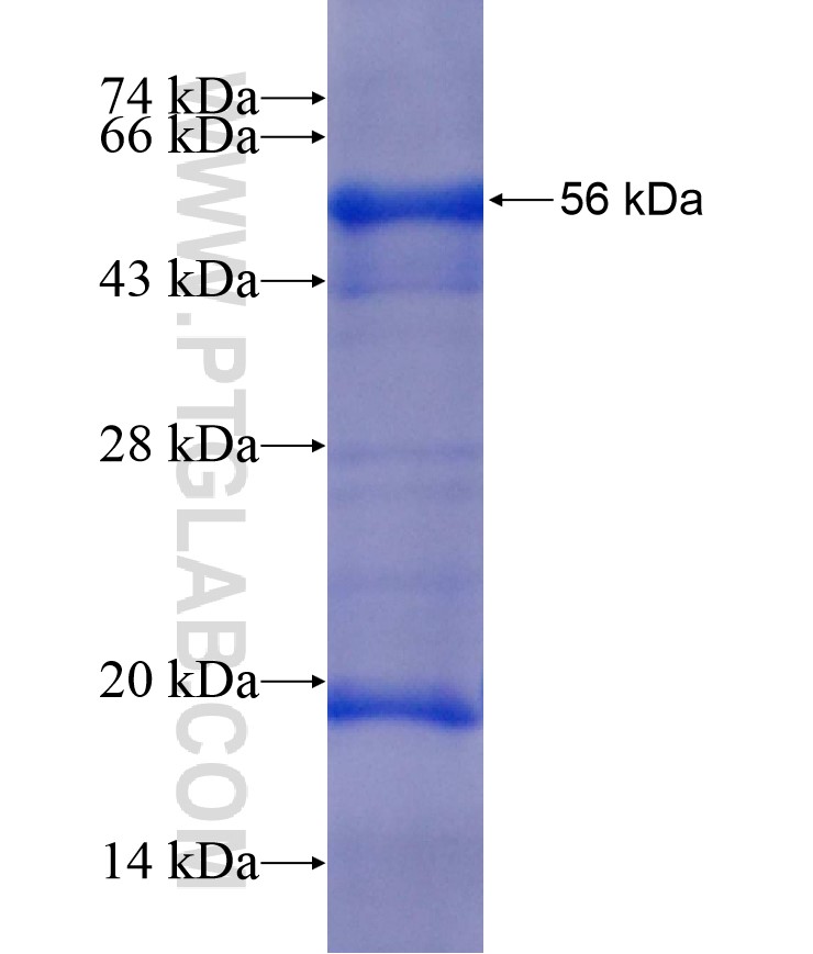 SGK1 fusion protein Ag17888 SDS-PAGE