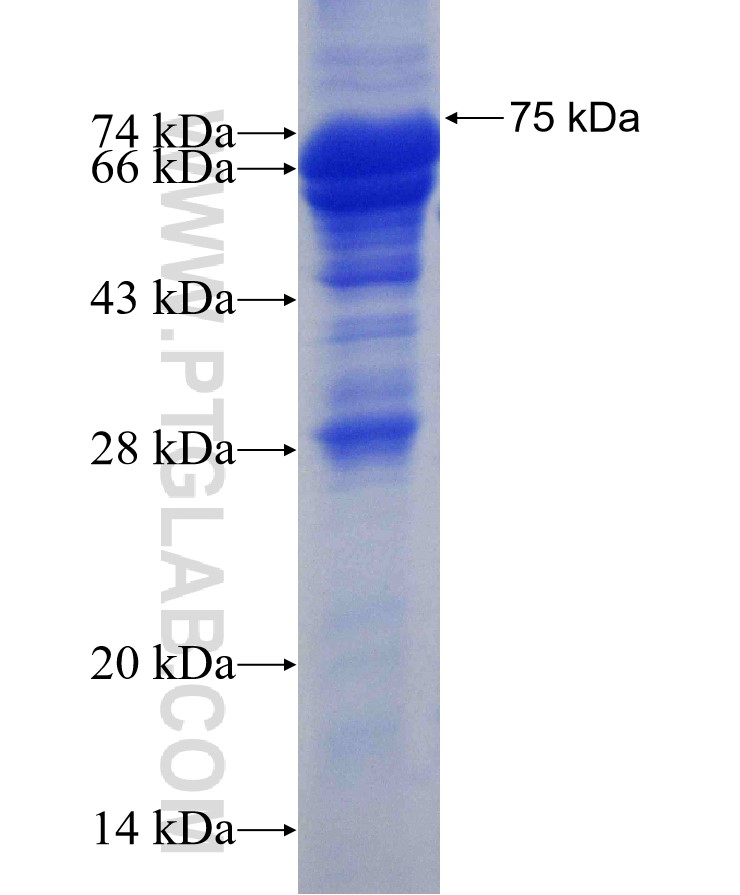 SGK2 fusion protein Ag1669 SDS-PAGE