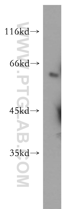 WB analysis of HeLa using 12699-1-AP