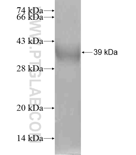 SGK493 fusion protein Ag20720 SDS-PAGE SGK493 fusion protein Ag20720 SDS-PAGE