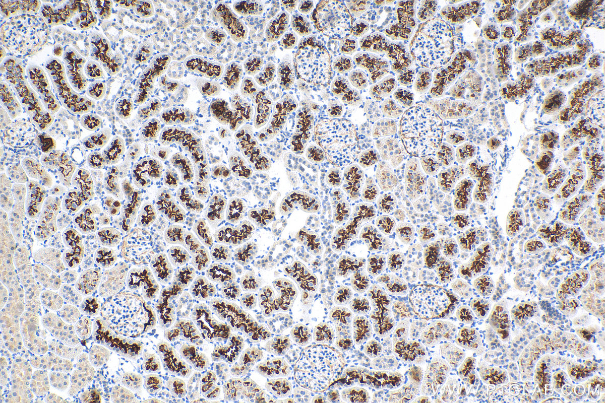 IHC staining of rat kidney using 24654-1-AP