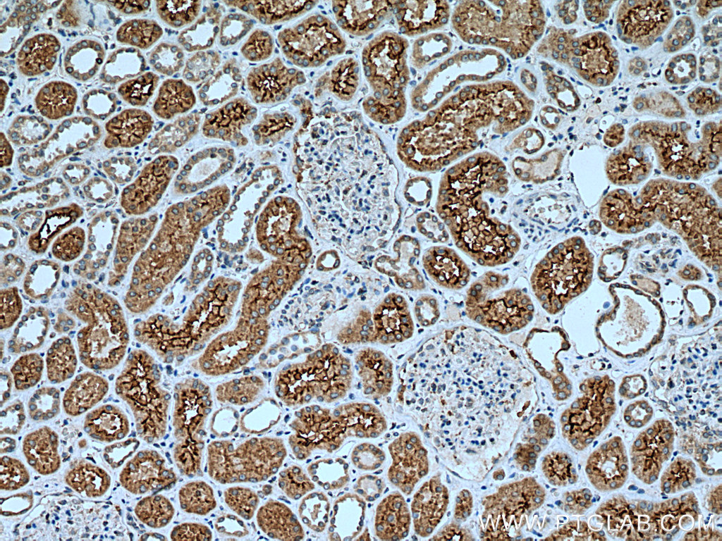 IHC staining of human kidney using 28683-1-AP (same clone as 28683-1-PBS)