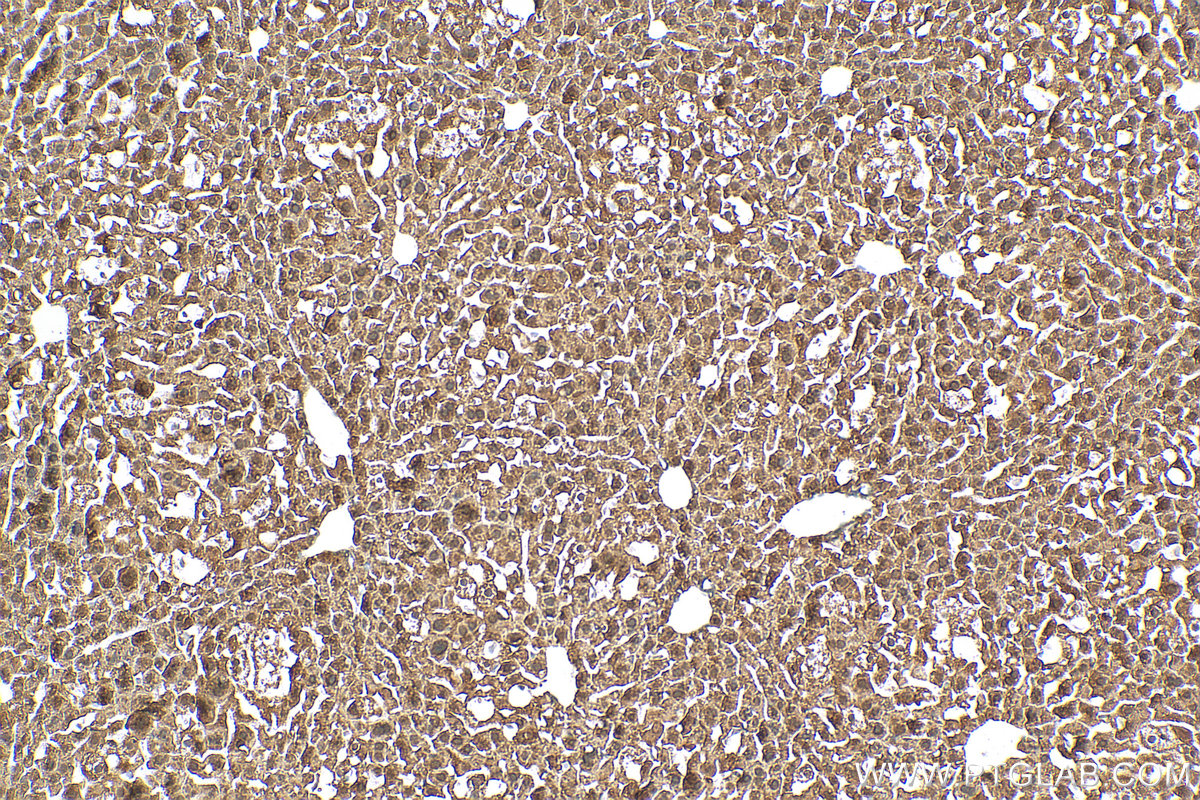 IHC staining of mouse liver using 19050-1-AP