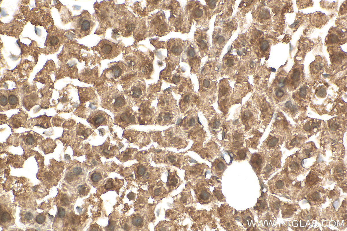 IHC staining of mouse liver using 19050-1-AP