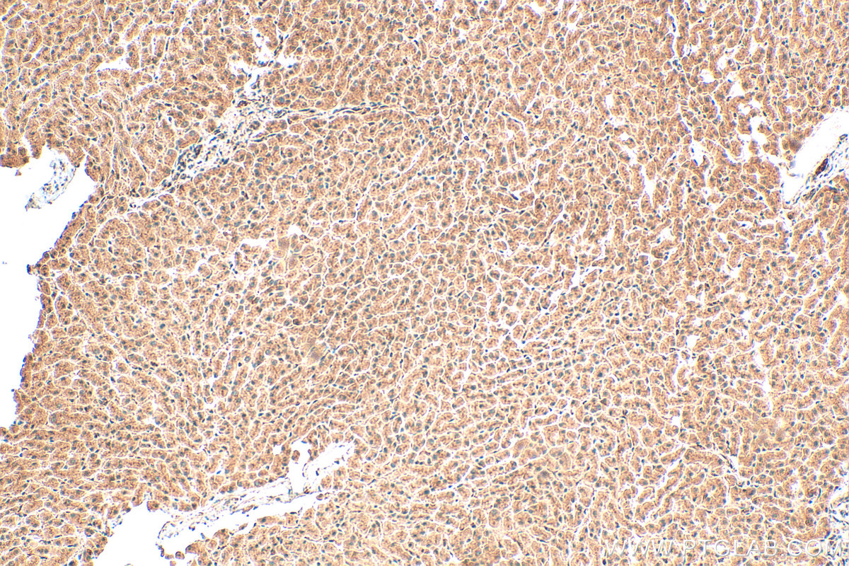 IHC staining of human liver using 19050-1-AP