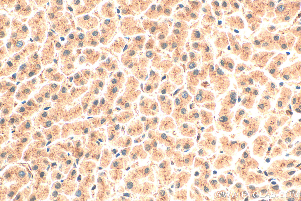 IHC staining of human liver using 19050-1-AP