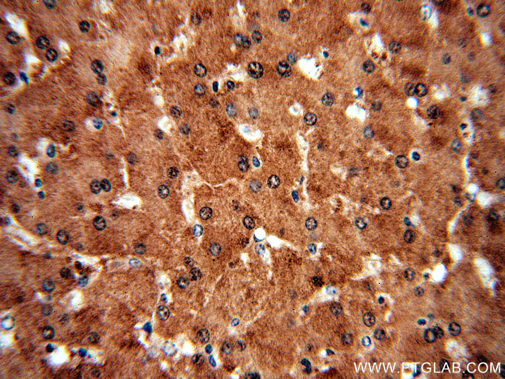 IHC staining of human liver using 19050-1-AP