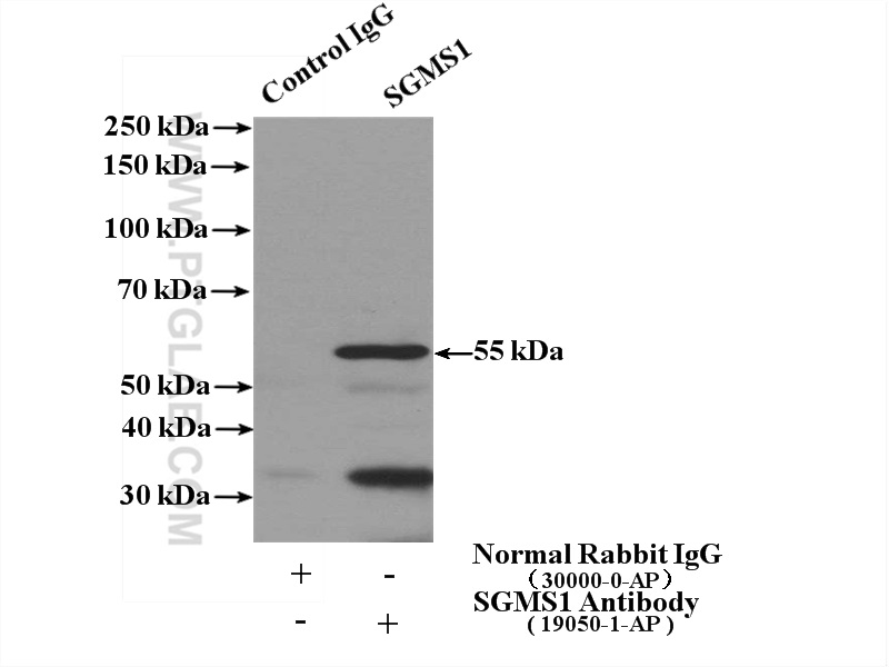 IP experiment of mouse heart using 19050-1-AP