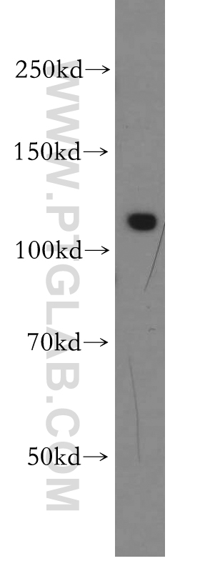 WB analysis of mouse testis using 21395-1-AP