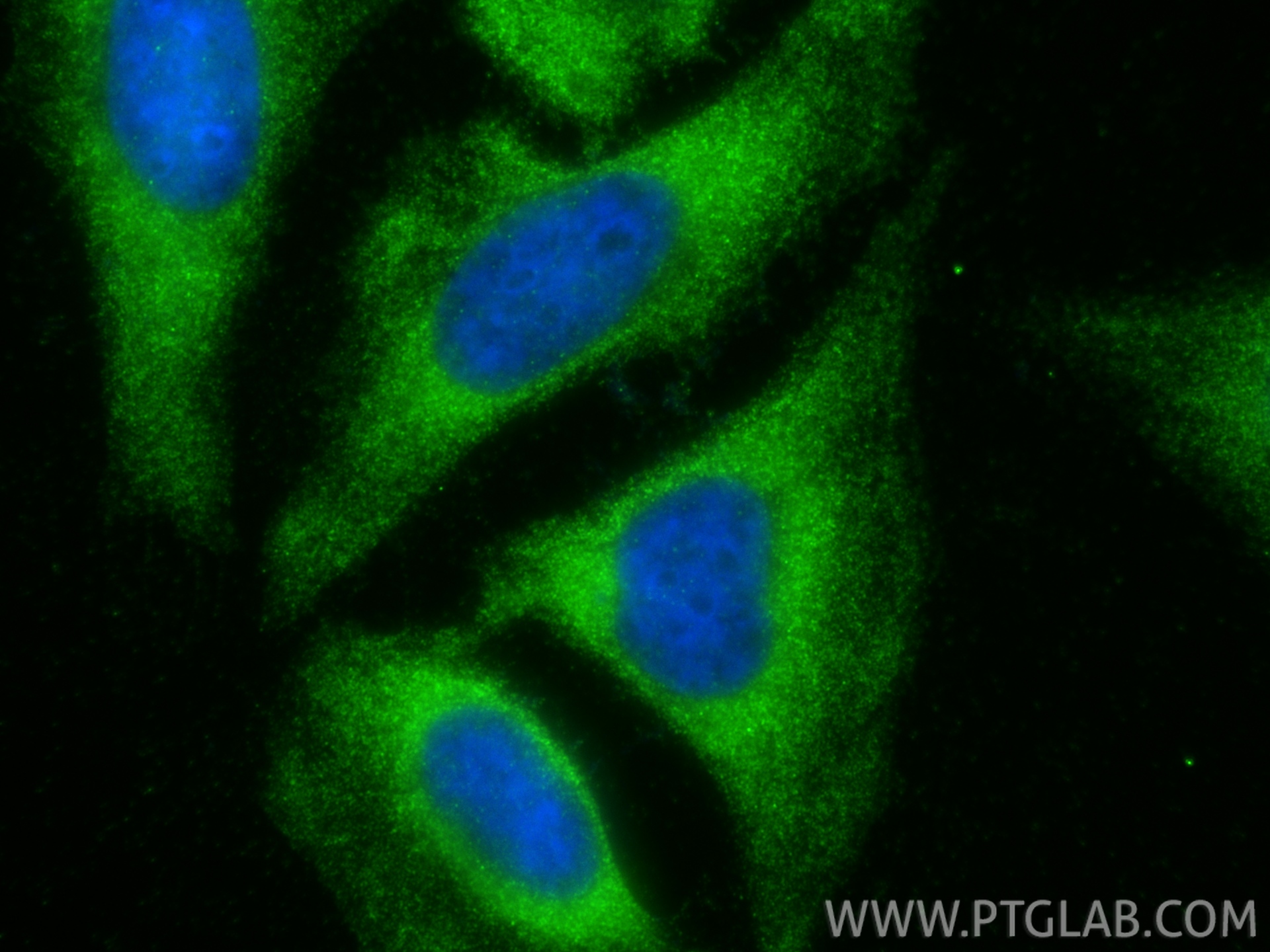 IF Staining of HeLa using 20825-1-AP