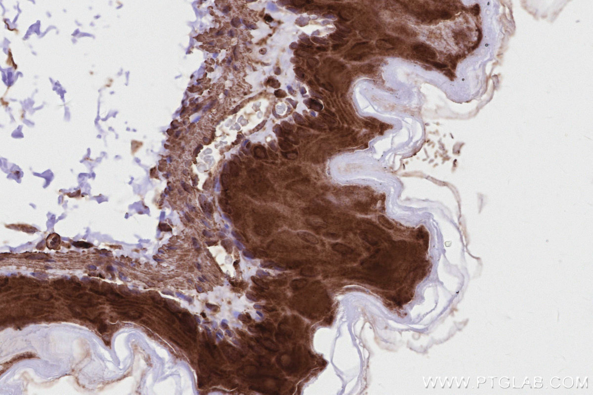 IHC staining of mouse stomach using 20825-1-AP