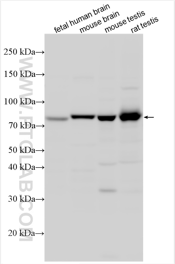 WB analysis using 20825-1-AP