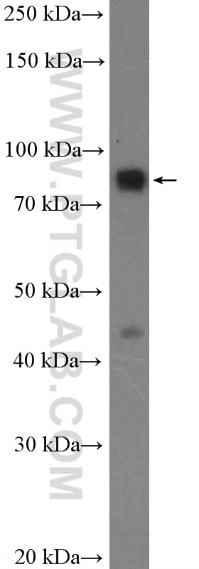 WB analysis of fetal human brain using 20825-1-AP