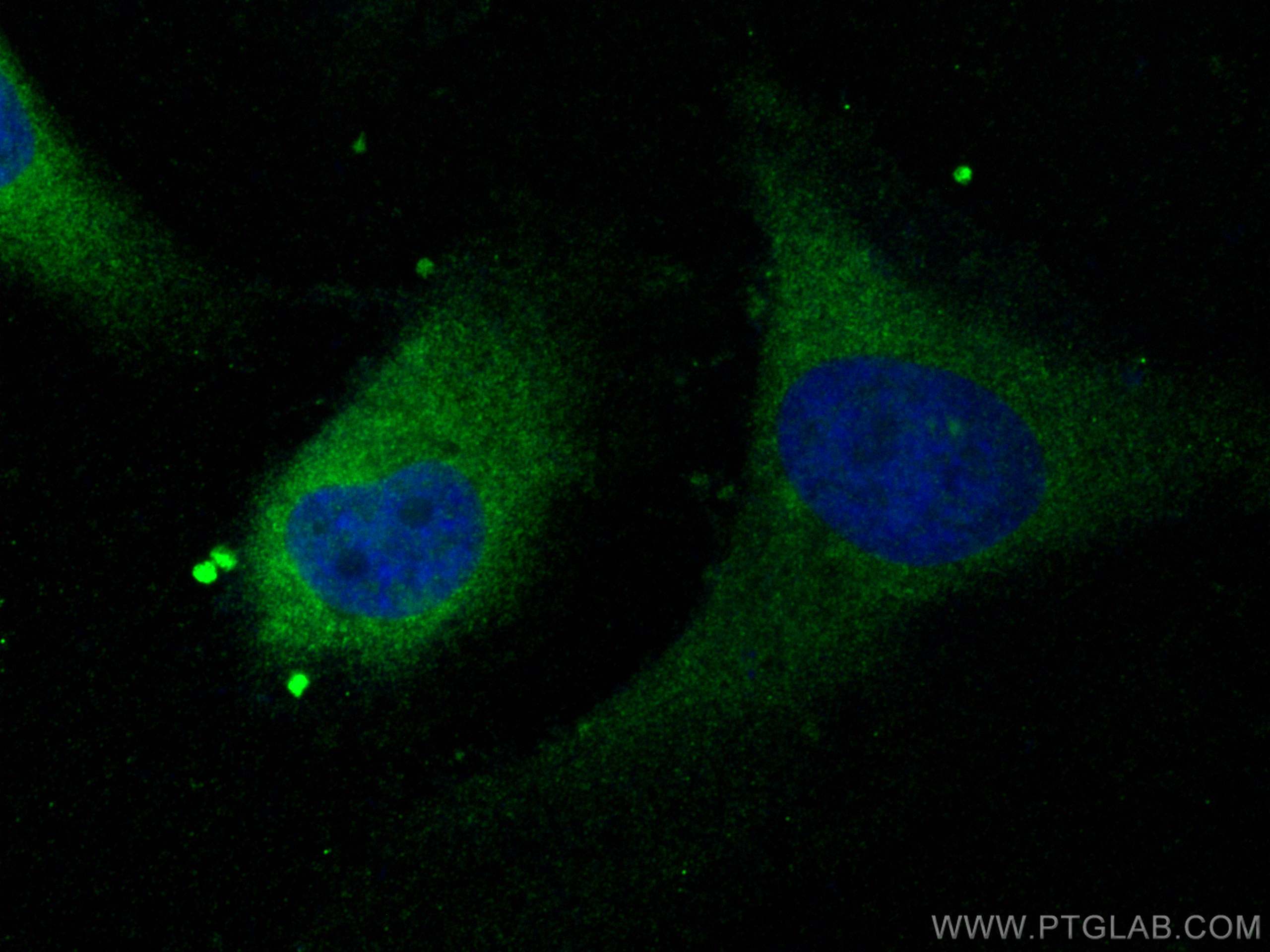 IF Staining of HeLa using 11019-2-AP (same clone as 11019-2-PBS)