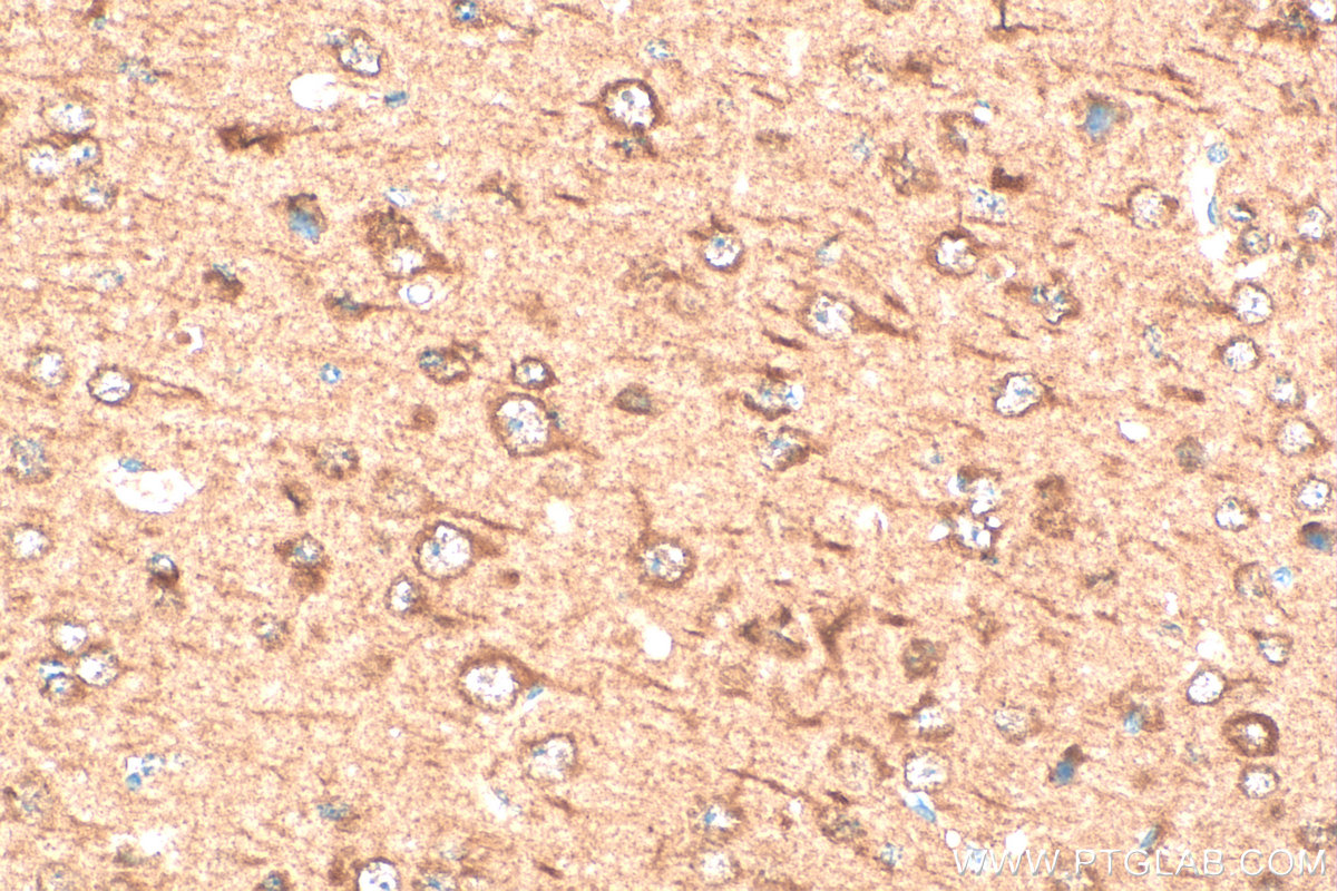 Immunohistochemical analysis of paraffin-embedded mouse brain tissue slide using 11019-2-AP (SGTA antibody) at dilution of 1:400 (under 40x lens). Heat mediated antigen retrieval with Tris-EDTA buffer (pH 9.0). IHC staining of mouse brain using 11019-2-AP