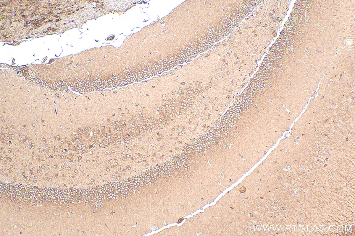 Immunohistochemical analysis of paraffin-embedded mouse brain tissue slide using 11019-2-AP (SGTA antibody) at dilution of 1:400 (under 10x lens). Heat mediated antigen retrieval with Tris-EDTA buffer (pH 9.0). IHC staining of mouse brain using 11019-2-AP