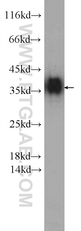 WB analysis of K-562 using 11019-2-AP (same clone as 11019-2-PBS)