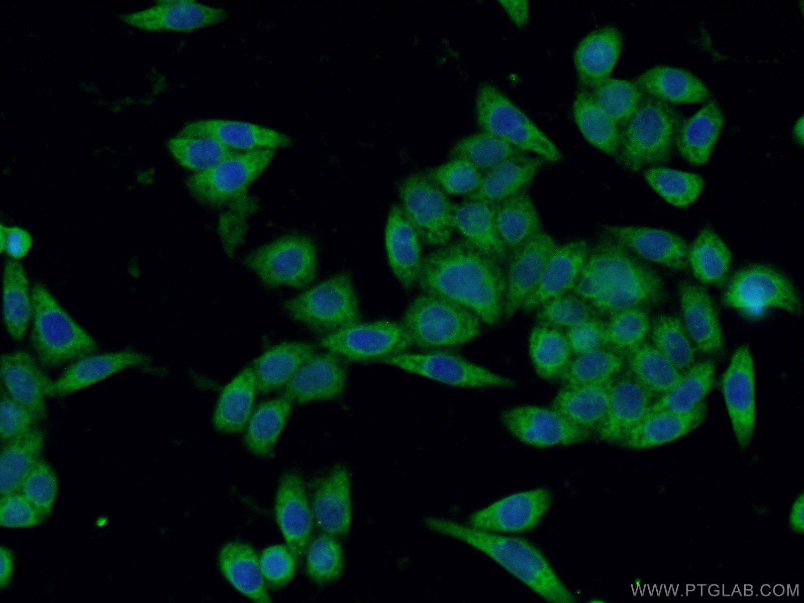 IF Staining of HeLa using 60305-1-Ig