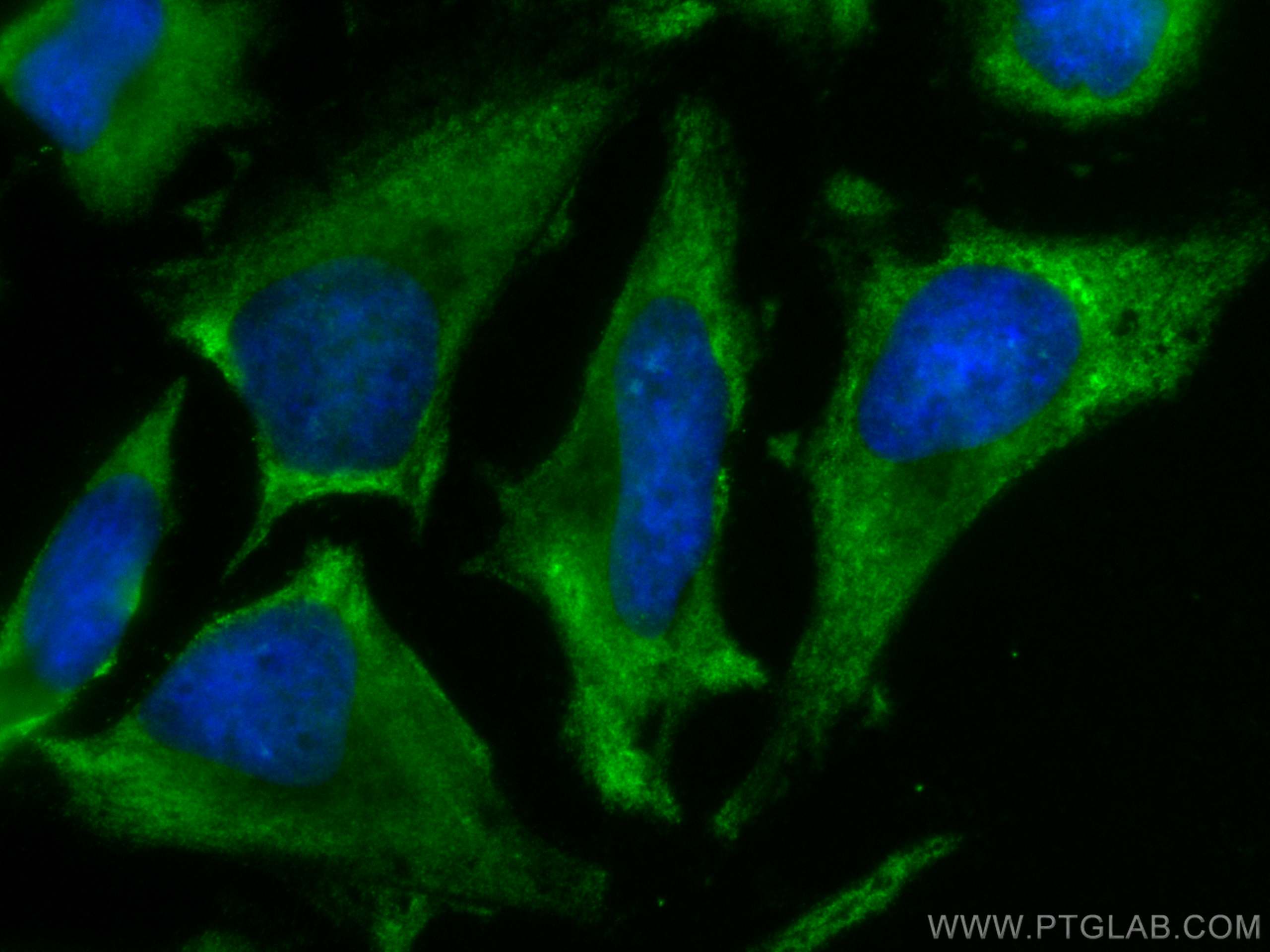 IF Staining of HeLa using CL488-60305