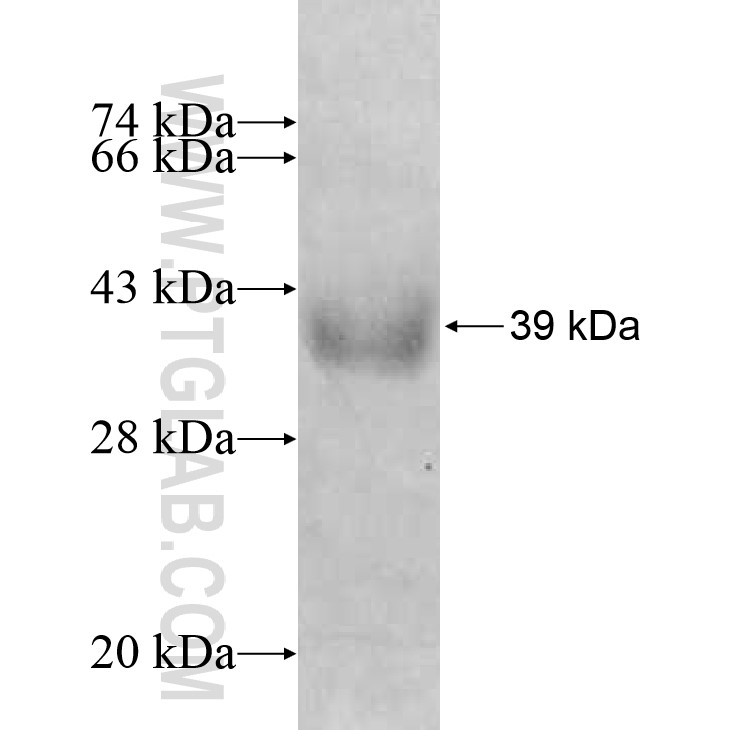 SGTB fusion protein Ag8917 SDS-PAGE SGTB fusion protein Ag8917 SDS-PAGE