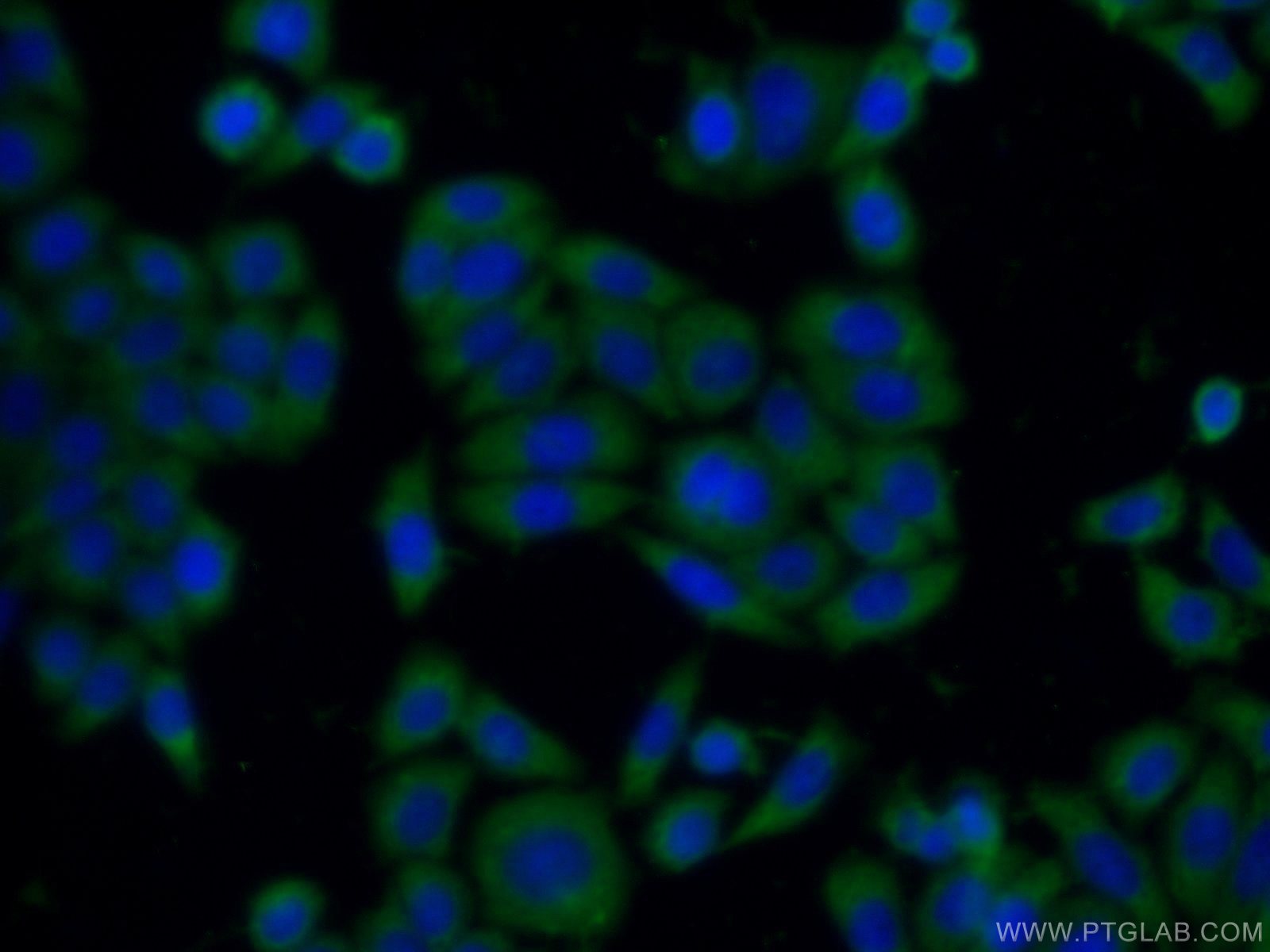 IF Staining of HeLa using 12226-1-AP