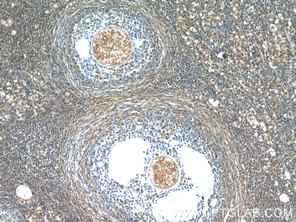 IHC staining of human ovary using 12226-1-AP