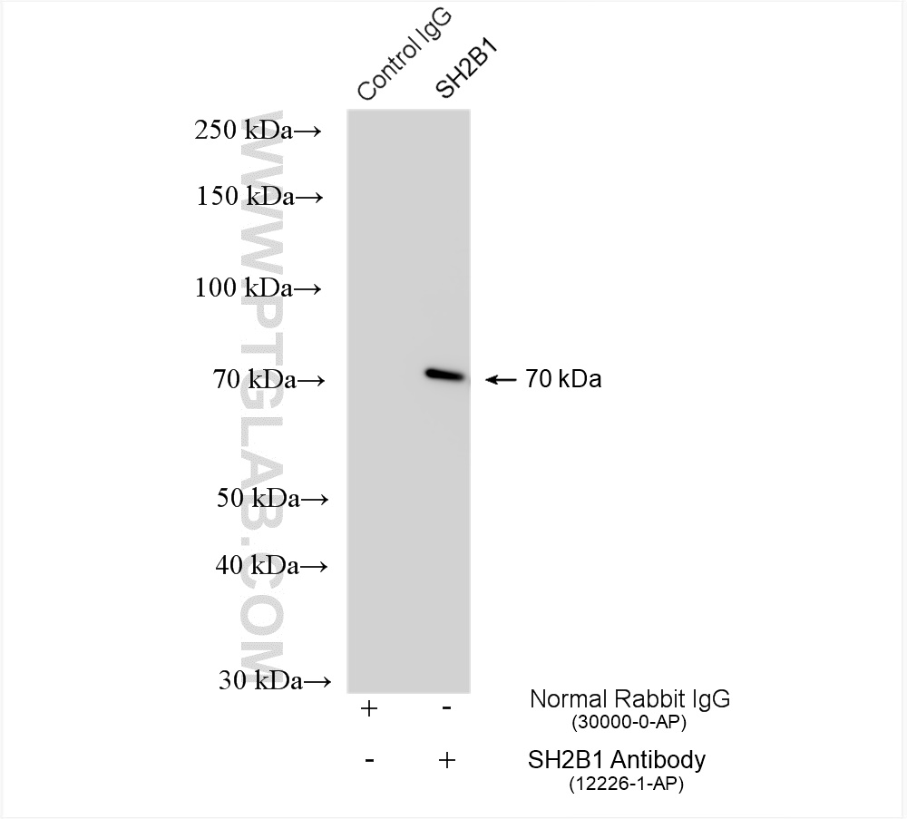 IP experiment of HepG2 using 12226-1-AP IP experiment of HepG2 using 12226-1-AP