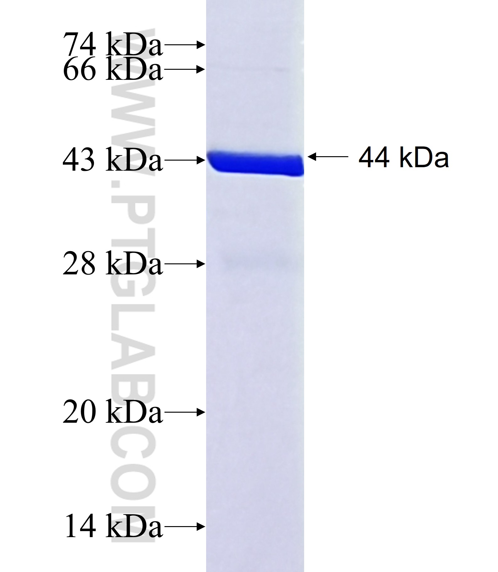 SH2B2 fusion protein Ag40992 SDS-PAGE SH2B2 fusion protein Ag40992 SDS-PAGE
