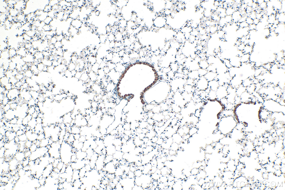 IHC staining of mouse lung using 11868-1-AP IHC staining of mouse lung using 11868-1-AP