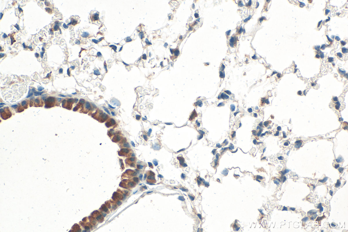 IHC staining of mouse lung using 11868-1-AP IHC staining of mouse lung using 11868-1-AP