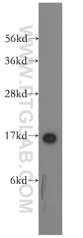 SH2D1A Polyclonal antibody