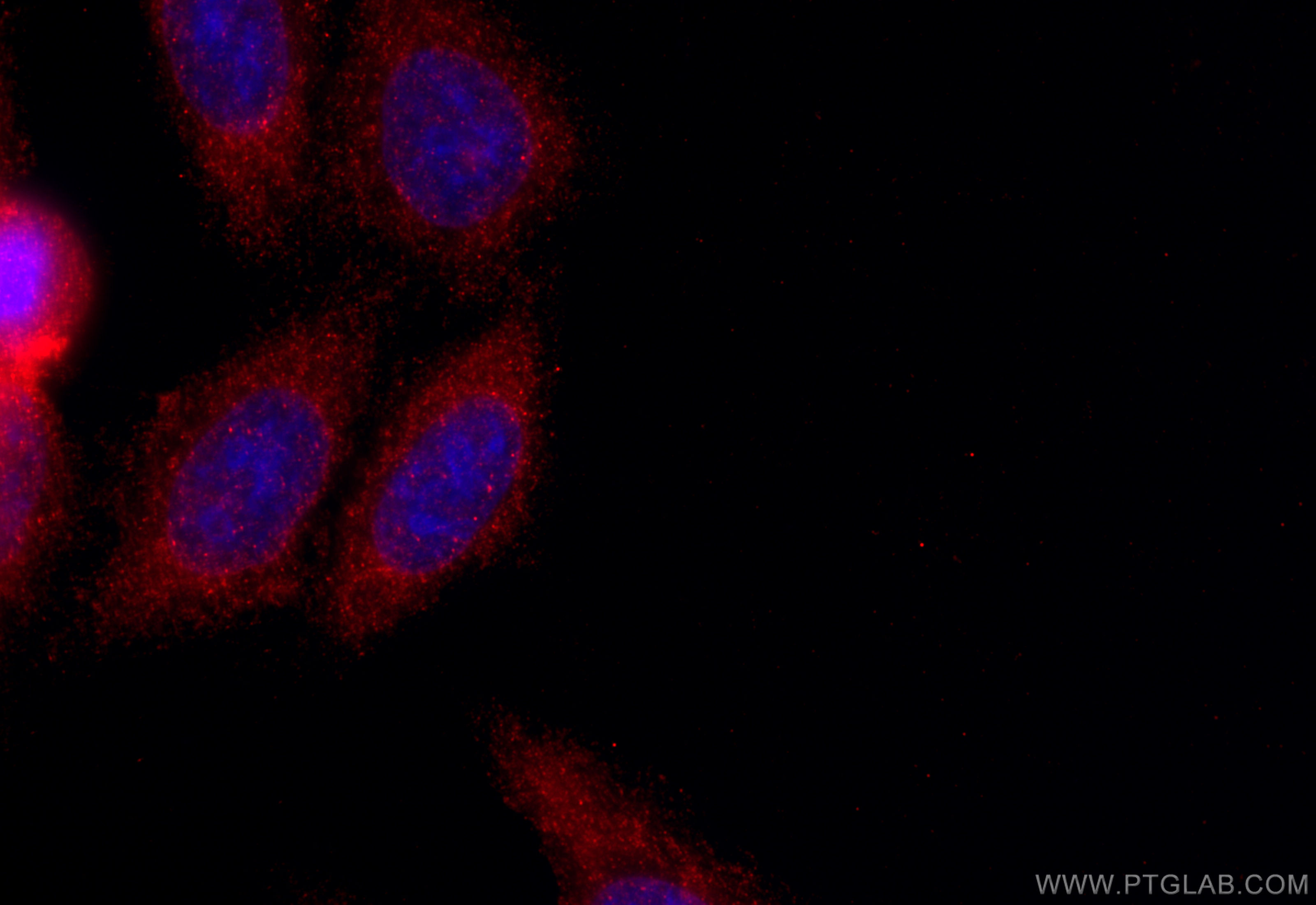IF Staining of HepG2 using 11871-1-AP