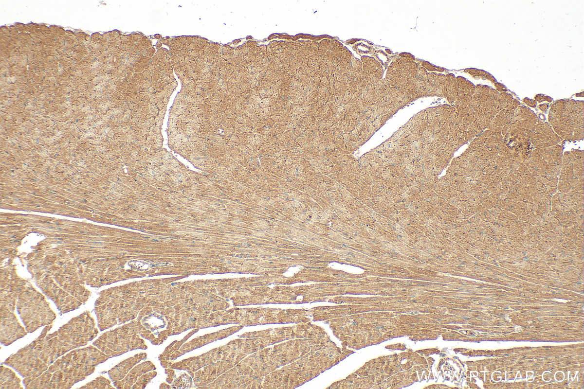 IHC staining of mouse heart using 18539-1-AP (same clone as 18539-1-PBS)