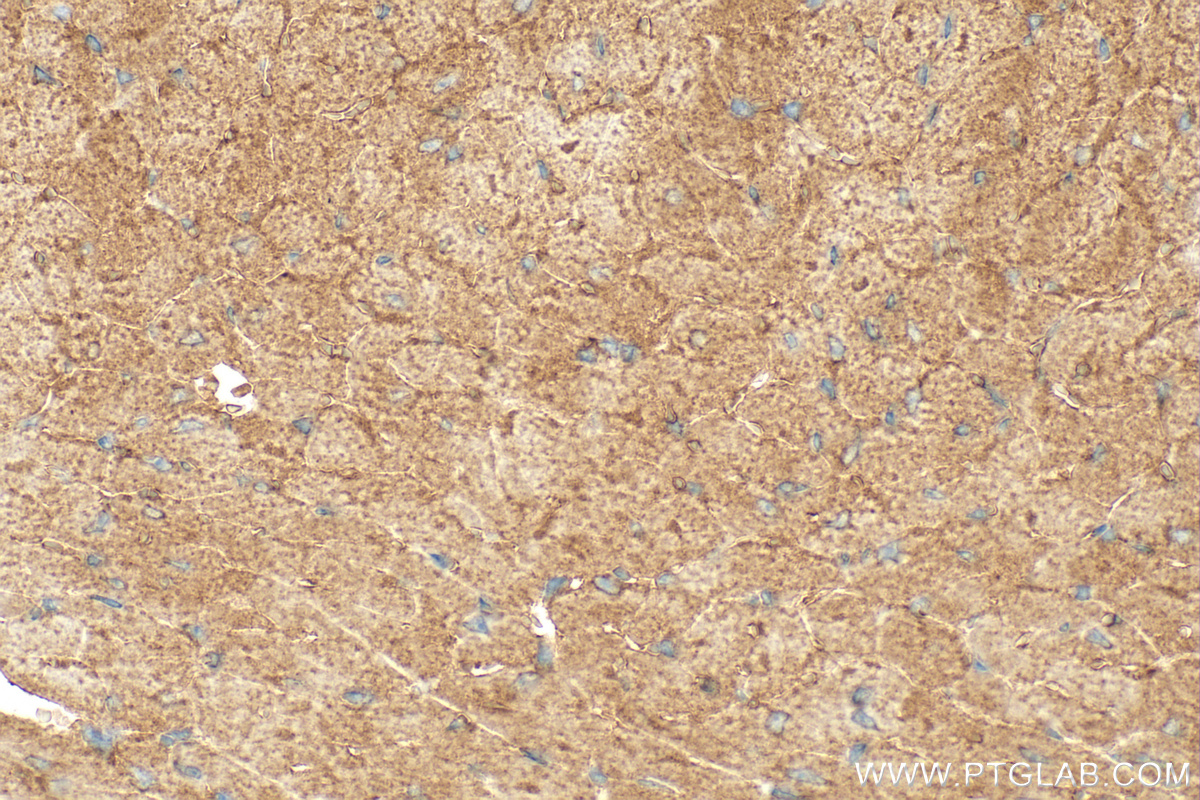 IHC staining of mouse heart using 18539-1-AP (same clone as 18539-1-PBS)