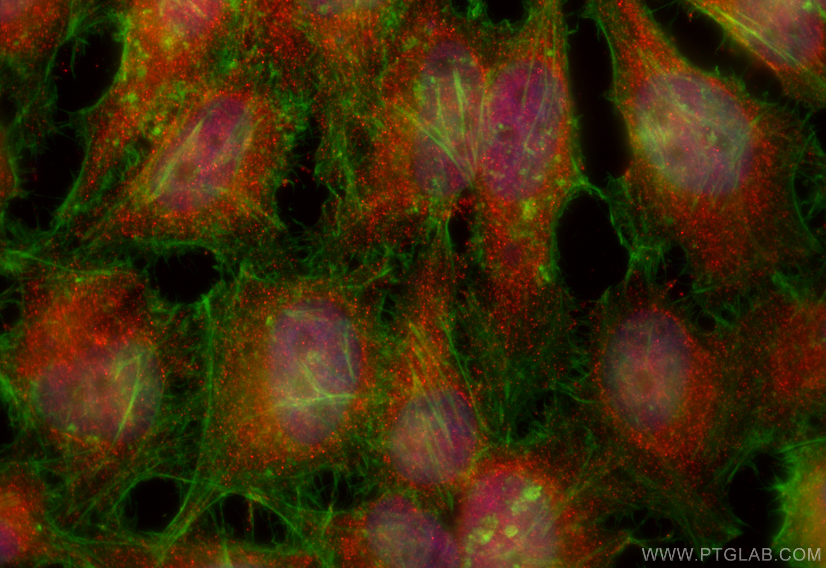 IF Staining of HeLa using 15641-1-AP