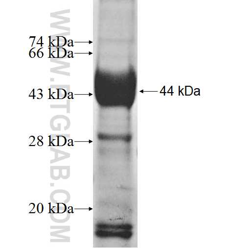 NSP1;SH2D3A fusion protein Ag8240 SDS-PAGE NSP1;SH2D3A fusion protein Ag8240 SDS-PAGE