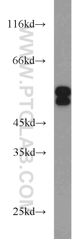 WB analysis of HeLa using 15957-1-AP