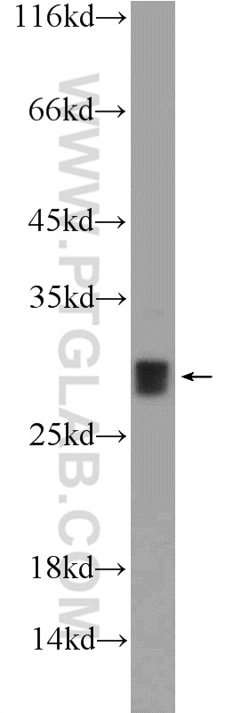 WB analysis of mouse heart using 21161-1-AP