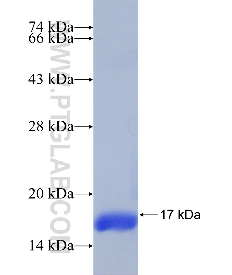 SH3BGRL3 fusion protein Ag31148 SDS-PAGE SH3BGRL3 fusion protein Ag31148 SDS-PAGE