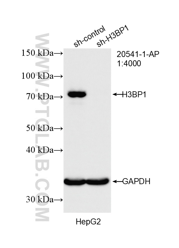 WB result of SH3BP1 antibody (20541-1-AP; 1:4000; incubated at room temperature for 1.5 hours) with sh-Control and sh-SH3BP1 transfected HepG2 cells. WB analysis of HepG2 using 20541-1-AP