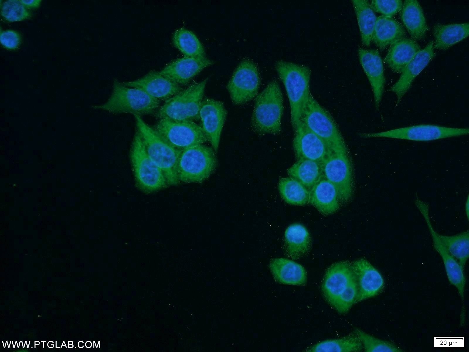 IF Staining of HeLa using 17691-1-AP