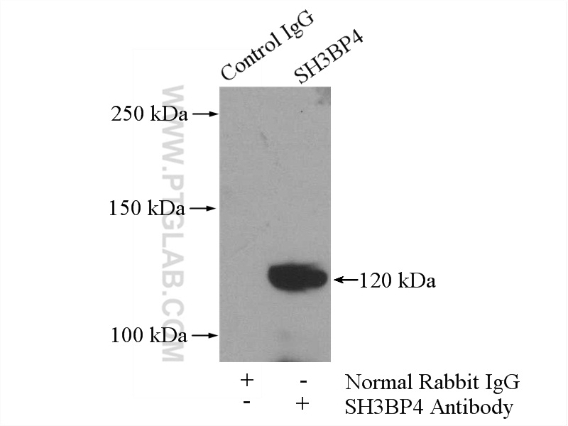 IP experiment of mouse lung using 17691-1-AP