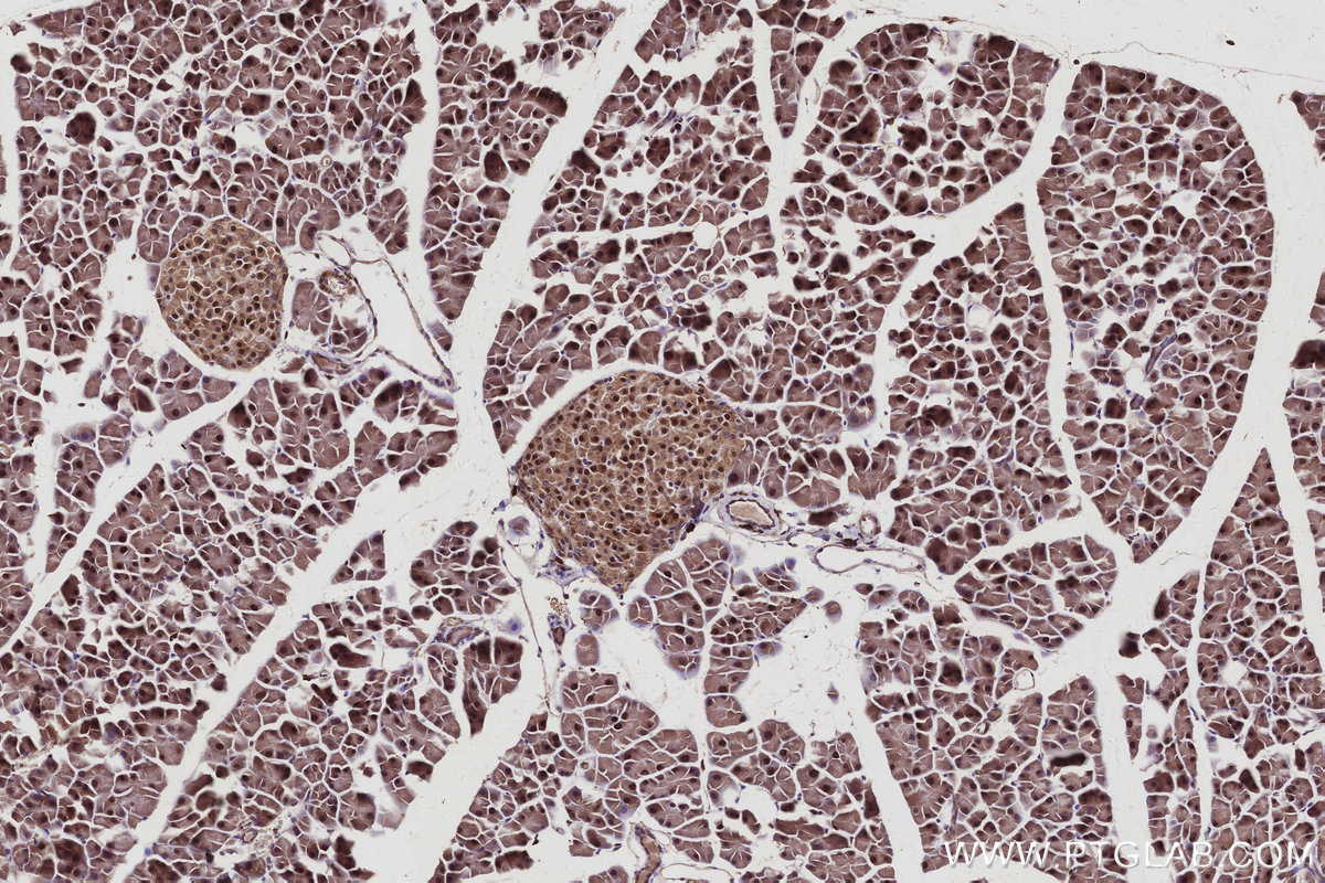 IHC staining of mouse pancreas using 68045-1-Ig IHC staining of mouse pancreas using 68045-1-Ig