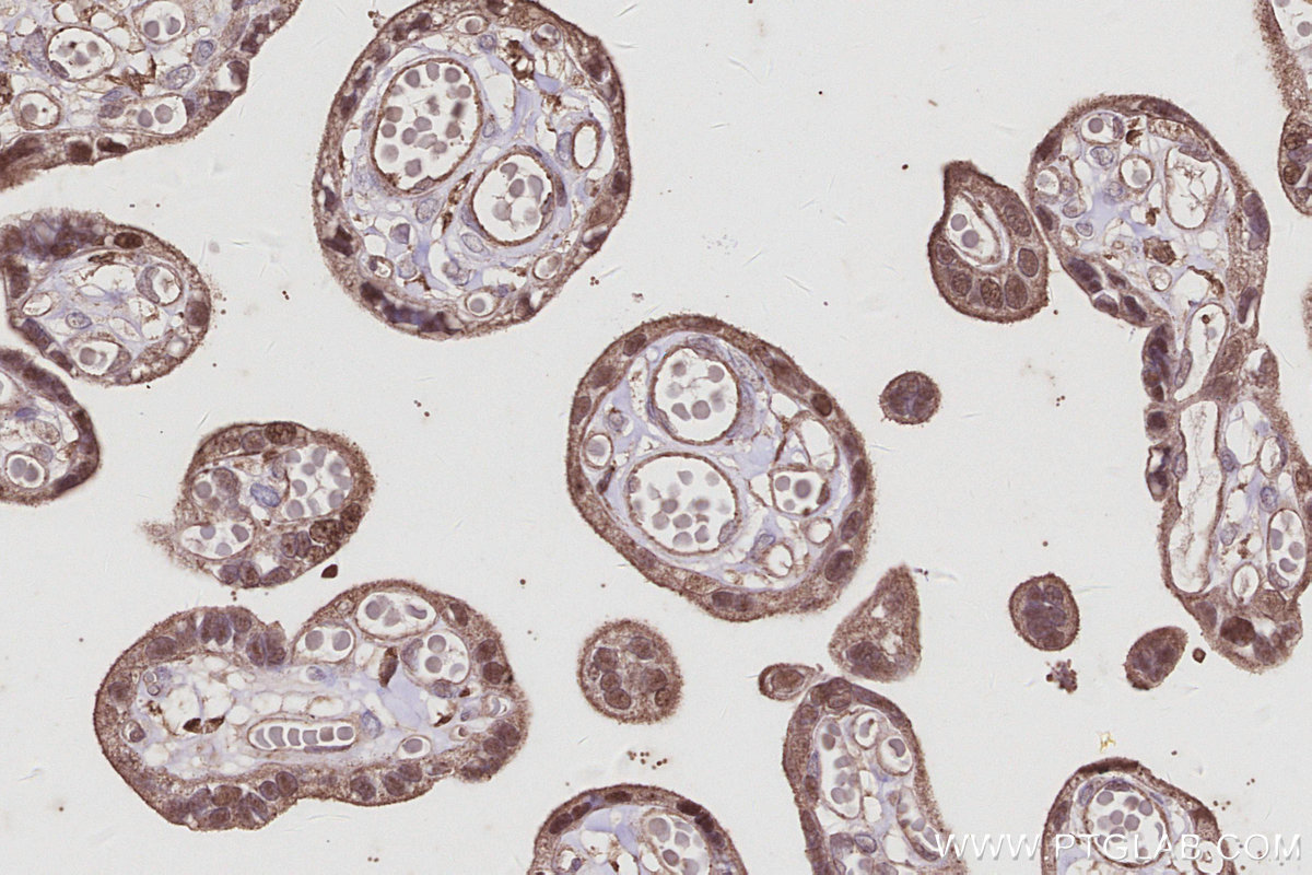 IHC staining of human placenta using 68045-1-Ig IHC staining of human placenta using 68045-1-Ig