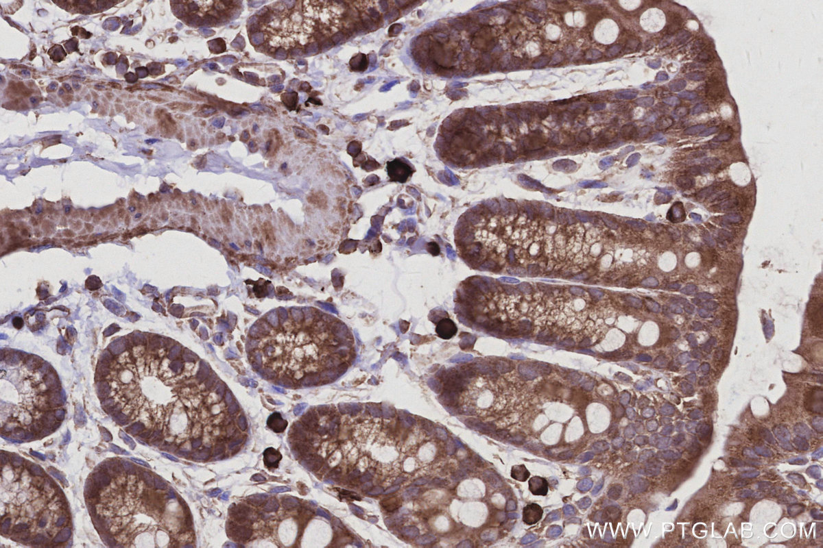 IHC staining of mouse colon using 68045-1-Ig IHC staining of mouse colon using 68045-1-Ig