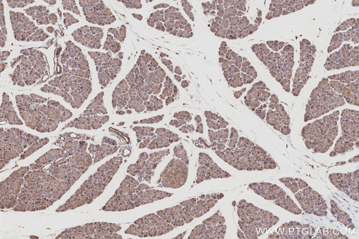IHC staining of rat pancreas using 68045-1-Ig IHC staining of rat pancreas using 68045-1-Ig