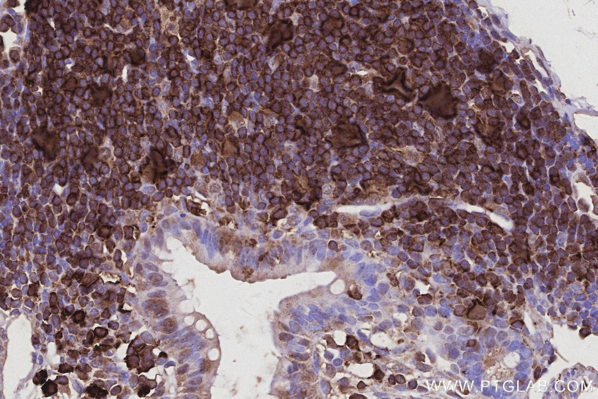 IHC staining of mouse colon using 68045-1-Ig IHC staining of mouse colon using 68045-1-Ig