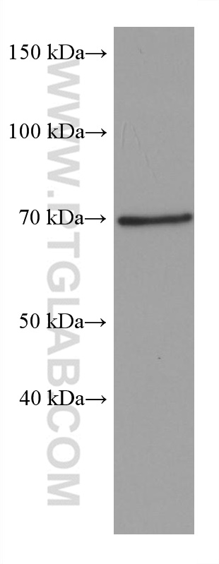 WB analysis of chicken brain using 67841-1-Ig